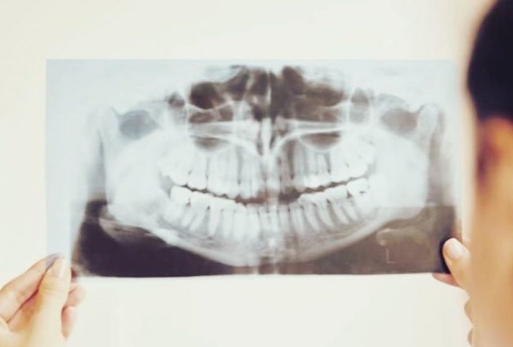 dentist holding up digital x-rays